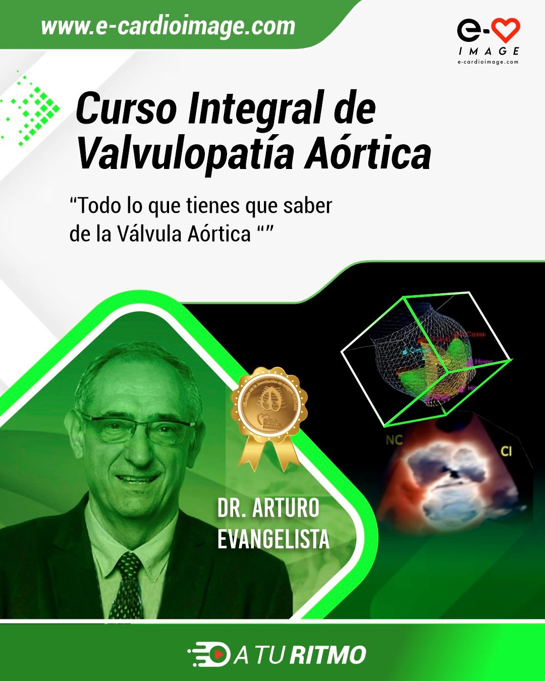 Curso Integral de Valvulopatía Aórtica - A tu ritmo