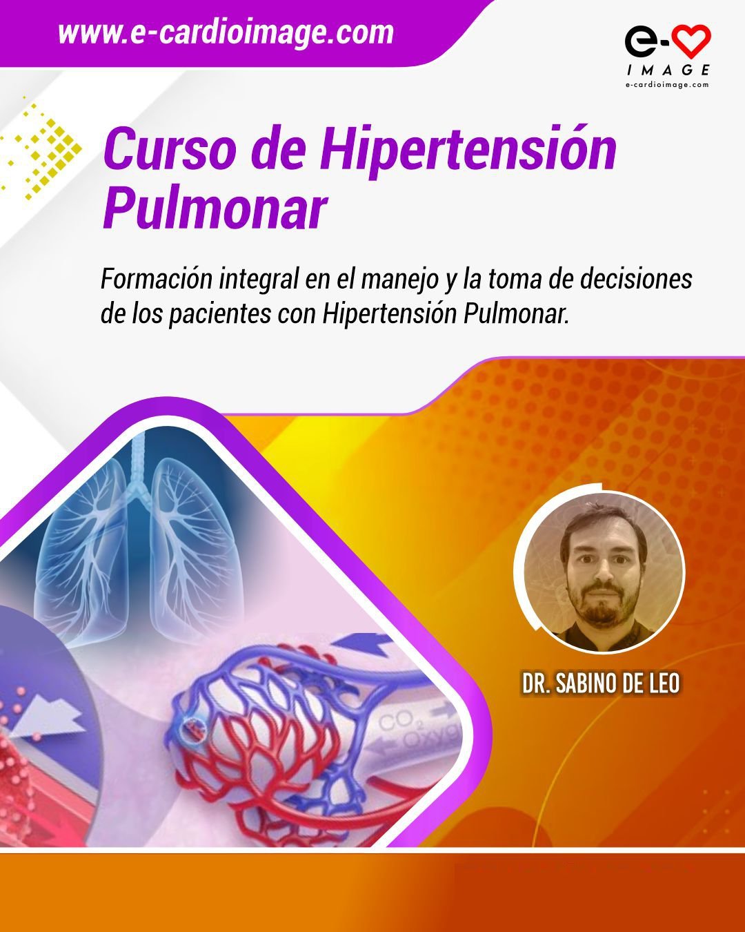 Curso Universitario de Hipertensión Pulmonar