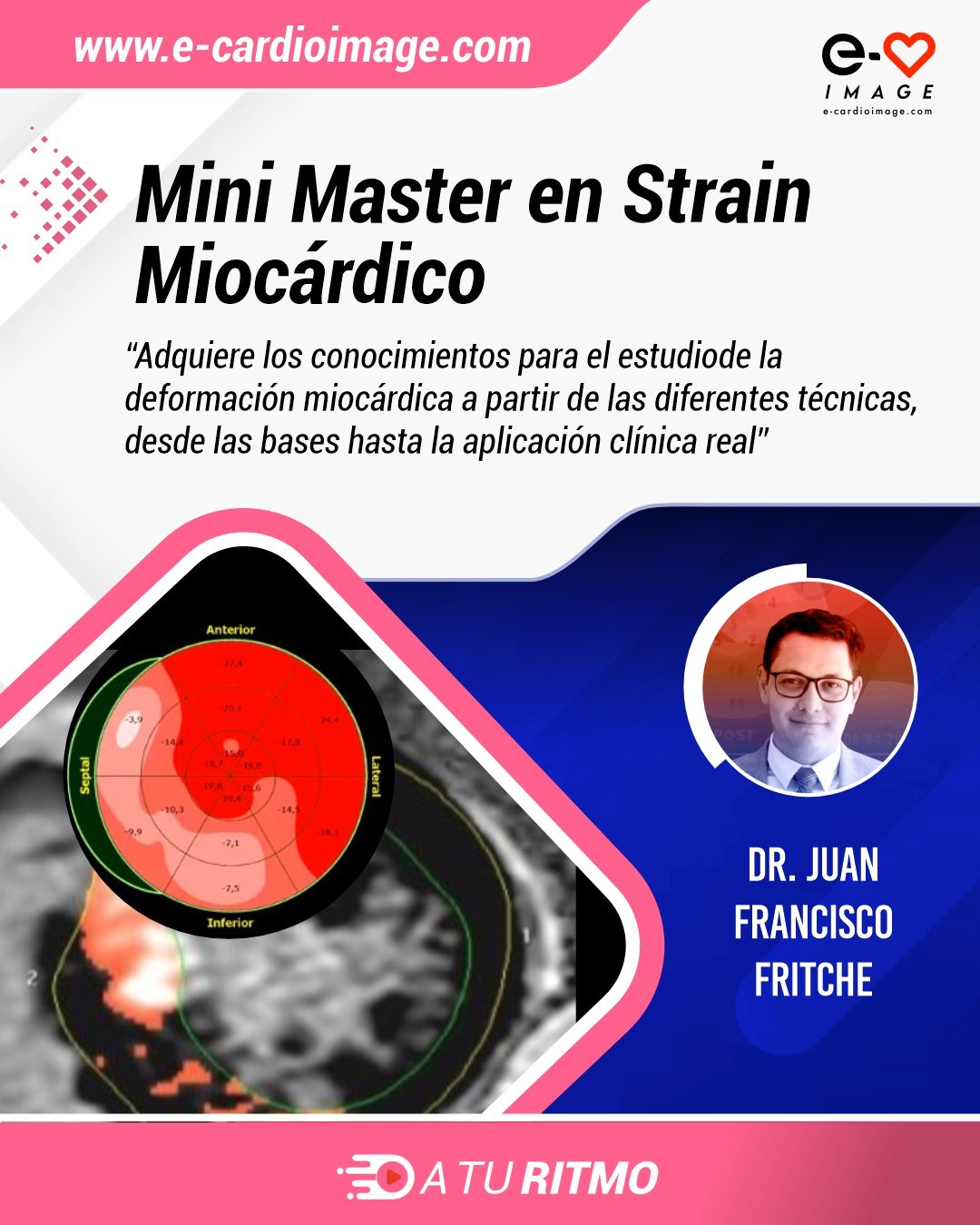 Mini Master en Strain Miocárdico - A tu ritmo